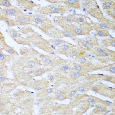 Immunohistochemistry-Paraffin: NUDT15 Antibody - BSA Free [NBP2-93605]