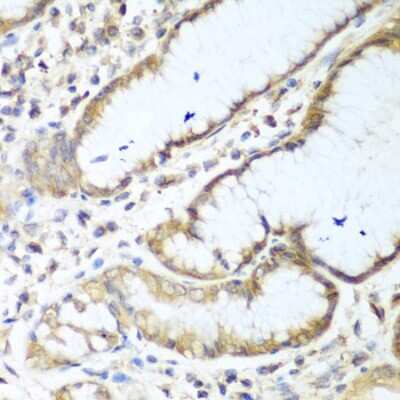 Immunohistochemistry-Paraffin: NUDT15 Antibody - BSA Free [NBP2-93605]