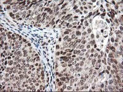Immunohistochemistry-Paraffin: NUDT18 Antibody (OTI5D7) [NBP2-01432]