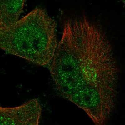Immunocytochemistry/ Immunofluorescence: NUDT18 Antibody [NBP1-83602]