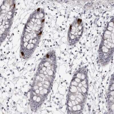 Immunohistochemistry-Paraffin: NUDT18 Antibody [NBP1-83602]