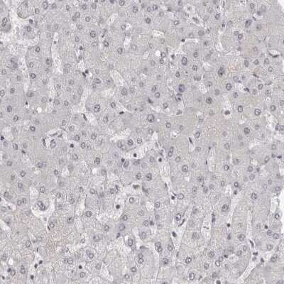 Immunohistochemistry-Paraffin: NUDT18 Antibody [NBP1-83602]