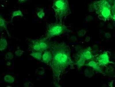 Immunocytochemistry/ Immunofluorescence: NUDT18 Antibody (OTI5D7) - Azide and BSA Free [NBP2-73110]