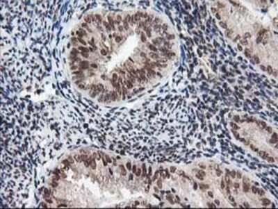 Immunohistochemistry: NUDT18 Antibody (OTI5D7) - Azide and BSA Free [NBP2-73110]