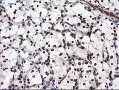 Immunohistochemistry: NUDT18 Antibody (OTI5D7) - Azide and BSA Free [NBP2-73110]
