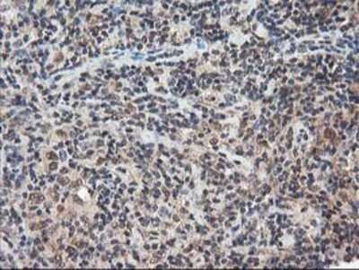 Immunohistochemistry: NUDT18 Antibody (OTI5D7) - Azide and BSA Free [NBP2-73110]