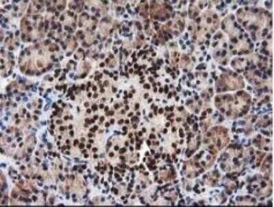Immunohistochemistry: NUDT18 Antibody (OTI5D7) - Azide and BSA Free [NBP2-73110]