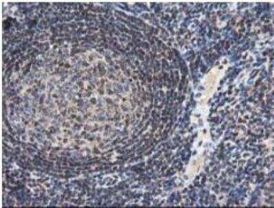 Immunohistochemistry-Paraffin: NUDT18 Antibody (OTI5D7) [NBP2-01432]