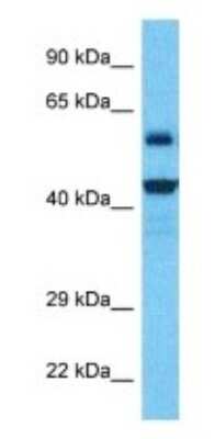 Western Blot: NUDT19 Antibody [NBP3-09678]
