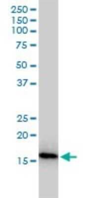 Western Blot: NUDT2 Antibody (4A4-3C3) [H00000318-M01]