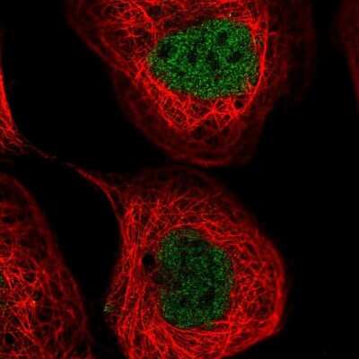 Immunocytochemistry/ Immunofluorescence: NUDT2 Antibody [NBP2-55236]