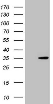 Western Blot: NUDT21 Antibody (OTI13H1)Azide and BSA Free [NBP2-73113]