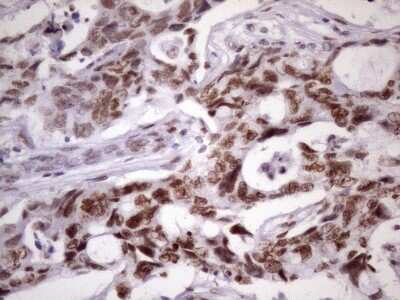 Immunohistochemistry: NUDT21 Antibody (OTI13H1) [NBP2-46276]