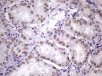 Immunohistochemistry: NUDT21 Antibody (OTI13H1) [NBP2-46276]