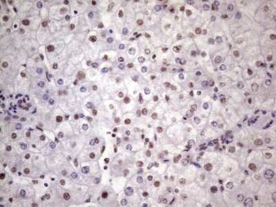 Immunohistochemistry: NUDT21 Antibody (OTI13H1) [NBP2-46276]