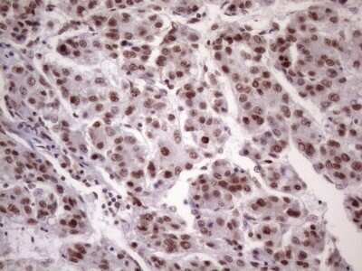 Immunohistochemistry: NUDT21 Antibody (OTI13H1) [NBP2-46276]