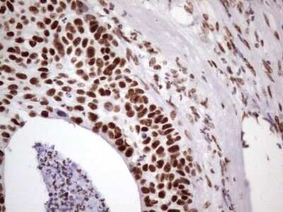 Immunohistochemistry: NUDT21 Antibody (OTI13H1) [NBP2-46276]