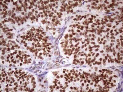 Immunohistochemistry: NUDT21 Antibody (OTI13H1) [NBP2-46276]