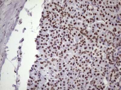 Immunohistochemistry: NUDT21 Antibody (OTI13H1) [NBP2-46276]