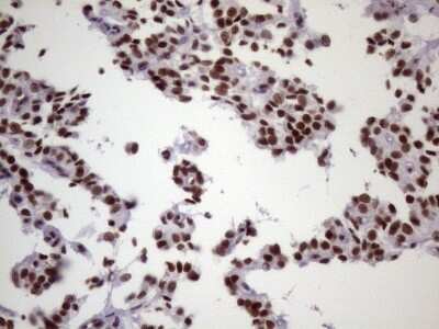 Immunohistochemistry: NUDT21 Antibody (OTI13H1) [NBP2-46276]