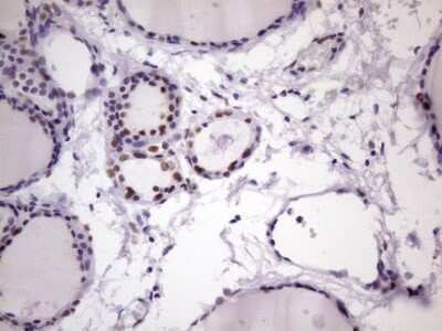 Immunohistochemistry: NUDT21 Antibody (OTI13H1) [NBP2-46276]
