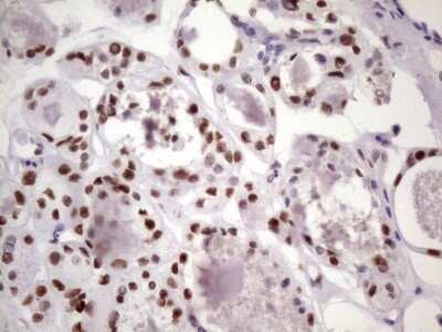 Immunohistochemistry: NUDT21 Antibody (OTI13H1) [NBP2-46276]