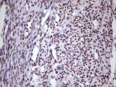 Immunohistochemistry: NUDT21 Antibody (OTI13H1) [NBP2-46276]