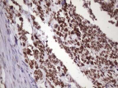 Immunohistochemistry: NUDT21 Antibody (OTI13H1) [NBP2-46276]