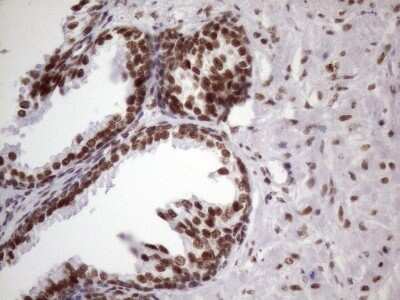 Immunohistochemistry: NUDT21 Antibody (OTI13H1) [NBP2-46276]