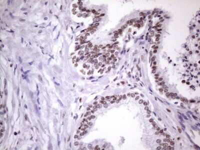 Immunohistochemistry: NUDT21 Antibody (OTI13H1) [NBP2-46276]