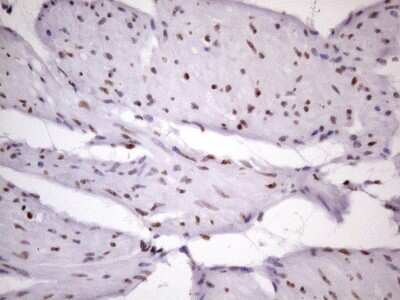 Immunohistochemistry: NUDT21 Antibody (OTI13H1) [NBP2-46276]
