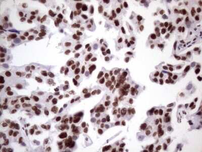 Immunohistochemistry: NUDT21 Antibody (OTI13H1) [NBP2-46276]