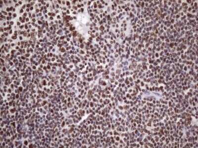 Immunohistochemistry: NUDT21 Antibody (OTI13H1) [NBP2-46276]