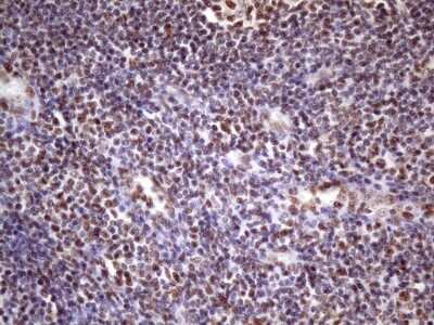 Immunohistochemistry: NUDT21 Antibody (OTI13H1) [NBP2-46276]