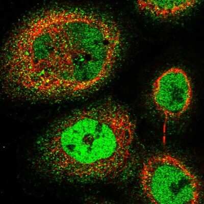 Immunocytochemistry/ Immunofluorescence: NUDT22 Antibody [NBP1-82754]