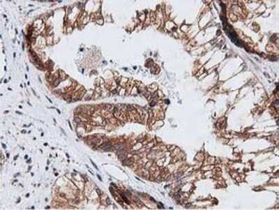 Immunohistochemistry-Paraffin: NUDT6 Antibody (OTI9D12) [NBP2-03554]