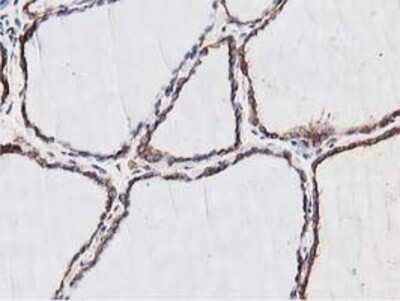 Immunohistochemistry-Paraffin: NUDT6 Antibody (OTI9D12) [NBP2-03554]