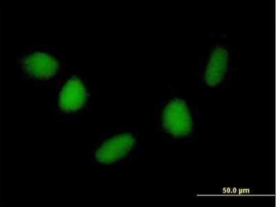 Immunocytochemistry/ Immunofluorescence: NUDT6 Antibody [H00011162-B01P]