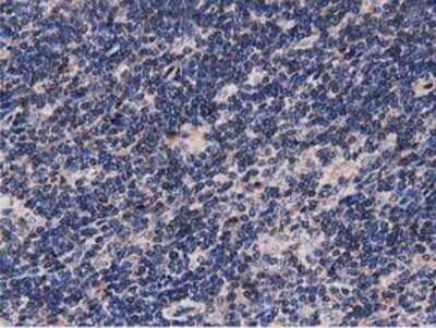 Immunohistochemistry: NUDT6 Antibody (OTI9D12) - Azide and BSA Free [NBP2-73121]