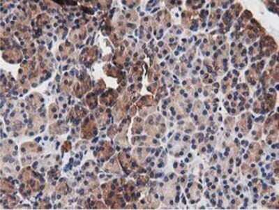 Immunohistochemistry: NUDT6 Antibody (OTI9D12) - Azide and BSA Free [NBP2-73121]