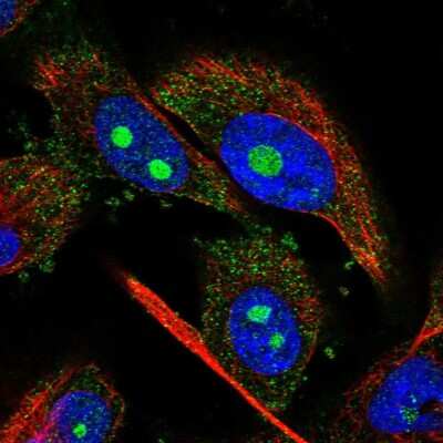 Immunocytochemistry/ Immunofluorescence: NUDT8 Antibody [NBP1-81908]