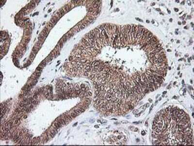 Immunohistochemistry-Paraffin: NUDT9 Antibody (OTI7A12) [NBP2-01072]