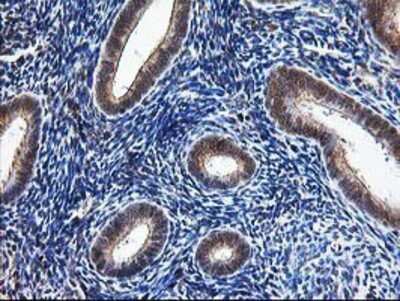 Immunohistochemistry-Paraffin: NUDT9 Antibody (OTI7A12) [NBP2-01072]