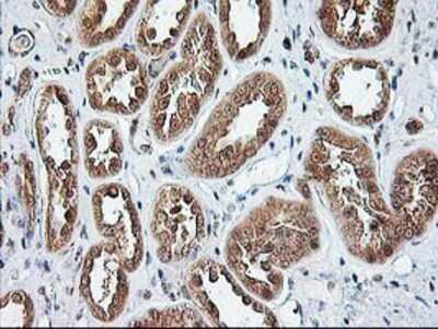 Immunohistochemistry-Paraffin: NUDT9 Antibody (OTI7A12) [NBP2-01072]