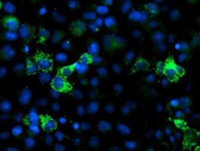 Immunocytochemistry/ Immunofluorescence: NUDT9 Antibody (OTI7A12) - Azide and BSA Free [NBP2-73126]