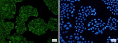 Immunocytochemistry/ Immunofluorescence: NUDT9 Antibody (S07-9C3) [NBP3-19723]