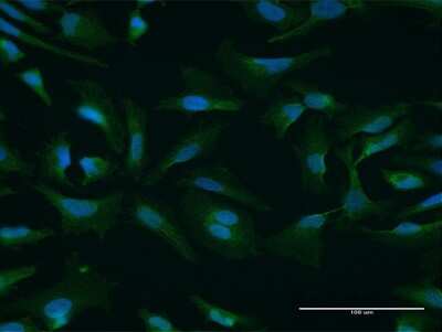 Immunocytochemistry/ Immunofluorescence: NUFIP1 Antibody [H00026747-B02P]