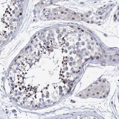 Immunohistochemistry-Paraffin: NUFIP1 Antibody [NBP1-82515]