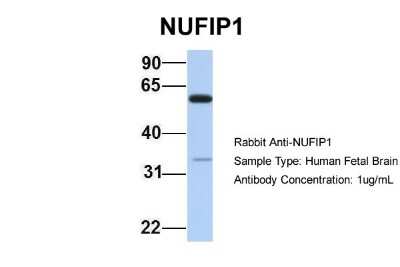 Western Blot: NUFIP1 Antibody [NBP2-87965]