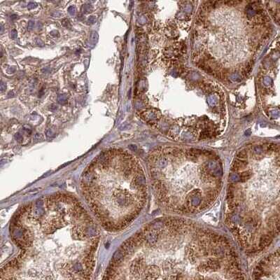 Immunohistochemistry-Paraffin: NULP1 Antibody [NBP1-92210]